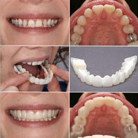 FlexiFit SmartSmile Cosmetic Teeth
