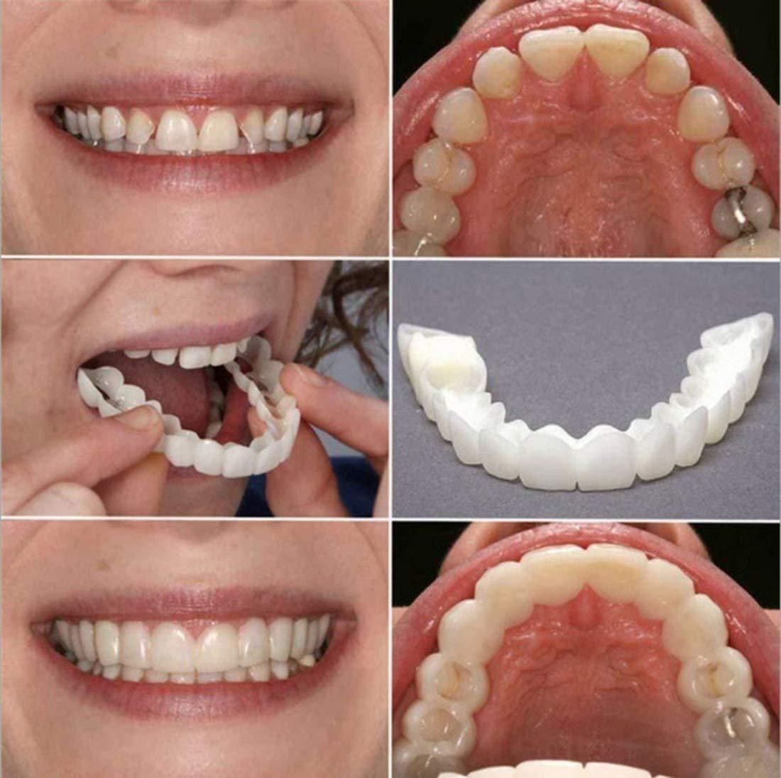 FlexiFit SmartSmile Cosmetic Teeth