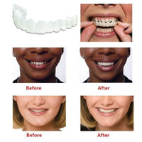 FlexiFit SmartSmile Cosmetic Teeth